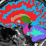 دانشمندان هاروارد-دوک با استفاده از یک اسکن MRI، ساعت پیری مغز را رمزگشایی کردند