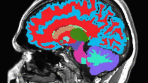 دانشمندان هاروارد-دوک با استفاده از یک اسکن MRI، ساعت پیری مغز را رمزگشایی کردند