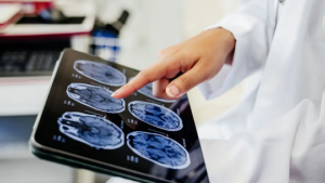 حافظه بلندمدت روشن/خاموش نیست، و توسط آبشاری از تایمرهای مولکولی شکل میگیرد