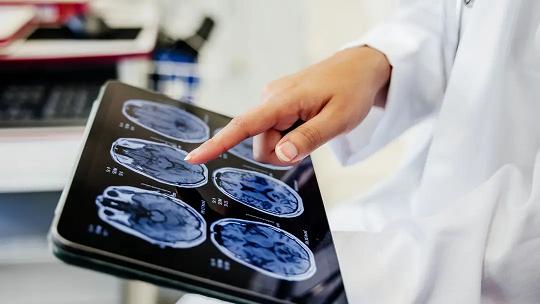 حافظه بلندمدت روشن/خاموش نیست، و توسط آبشاری از تایمرهای مولکولی شکل میگیرد