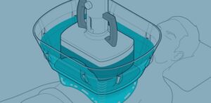 درمان با سونوگرافی، سختترین تومورهای سرطانی را هدف قرار میدهد
